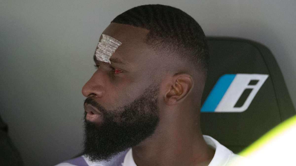 Rüdiger analiza su herida sufrida en Champions: “Lo volvería a hacer”
