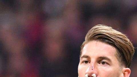 ¡OJO! Todos los lesionados, sancionados y apercibidos en la Champions 