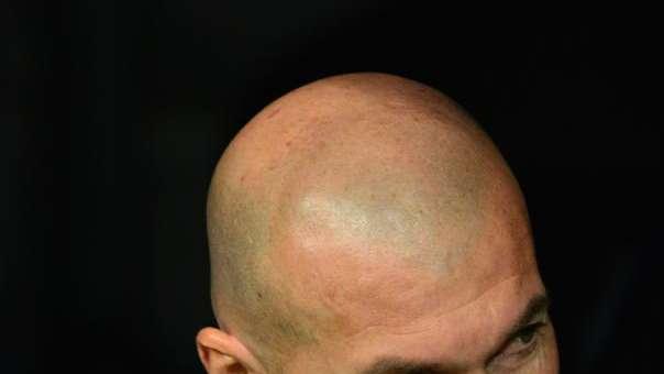 Zidane deja el primer borrón antes del clásico
