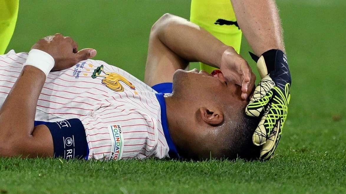 Alarma en el Real Madrid: Mbappé podría pasar por el quirófano