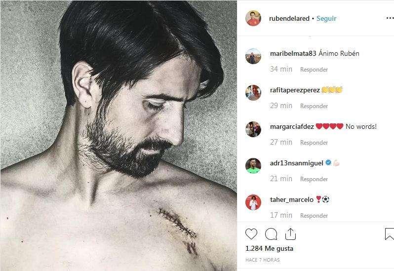 FOTO - De la Red muestra su tremenda cicatriz: "A veces la vida te golpea fuerte"