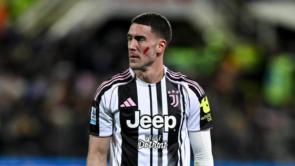 Vlahovic, il comunicato della Juve: "Operato oggi pomeriggio, da domani parte la riabilitazione"