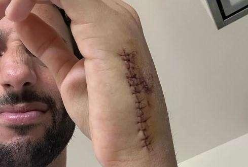 F1 | Infortunio Ricciardo, le condizioni: Horner lo mette ancora in dubbio