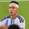 Lautaro dà il sangue per l'Argentina. In tutti i sensi