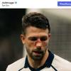 Mechele resta in campo con il naso rotto. E il Brugge lo esalta