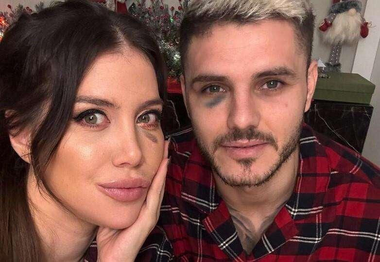 Scintille nel derby tra Icardi e Dzeko, Maurito pubblica un occhio nero e il bosniaco lo punzecchia