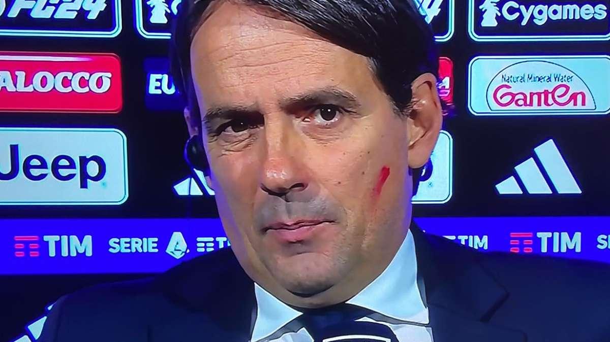 Inzaghi: "Ci prendiamo il pari. Siamo in emergenza con trasferte difficili, spero di riavere Sanchez a Lisbona"