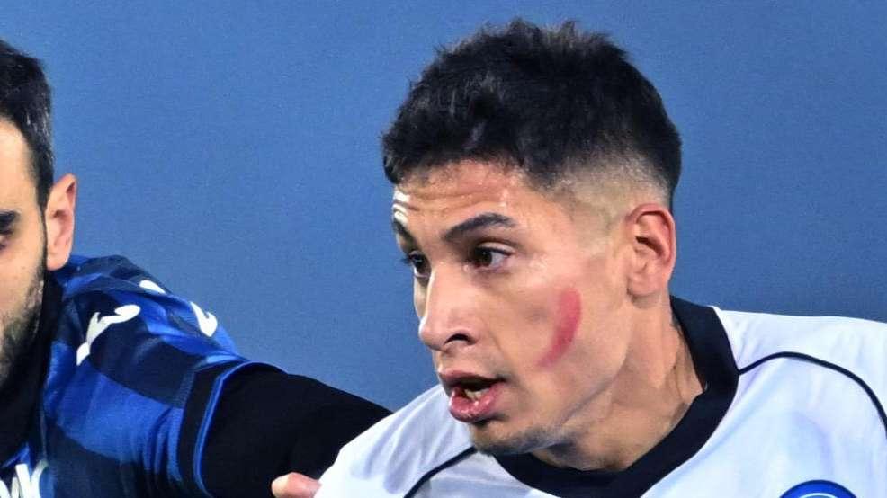 Napoli, per Olivera stop meno lungo del previsto: obiettivo rientro in Supercoppa