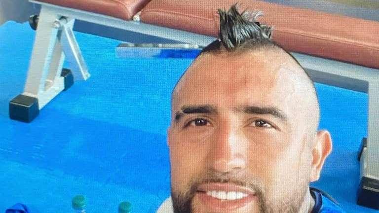Vidal prosegue la riabilitazione ad Appiano Gentile: "Andiamo avanti"