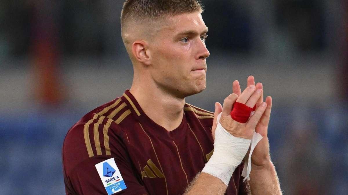 Qui Roma - Ansia per Dovbyk: infortunio in nazionale, out stasera?