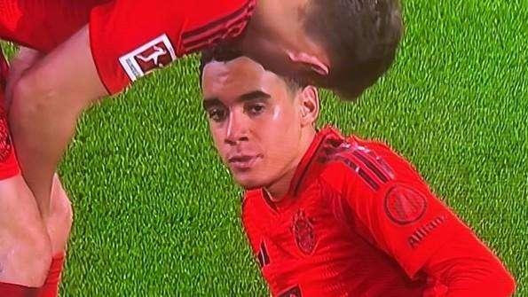 Infortunio Musiala, Kane e Kimmich in coro: "Pazzesco, è frustrante. Speriamo non sia grave"