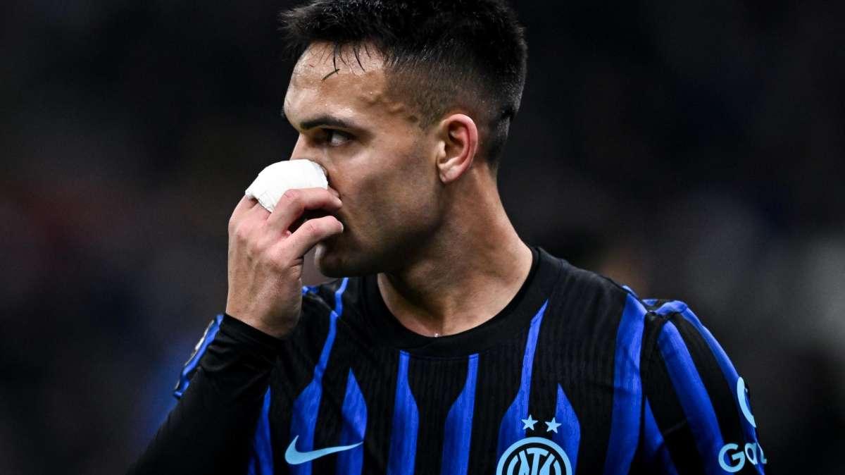 Lautaro e la 'Notte prima degli esami': l'ultima barzelletta sul suo infortunio 'sintetico'