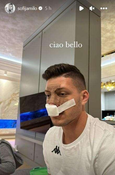 JOVIC, Operazione al setto nasale riuscita: la foto