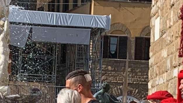 FOTO FV, Ecco il vistoso cerotto alla testa di Biraghi