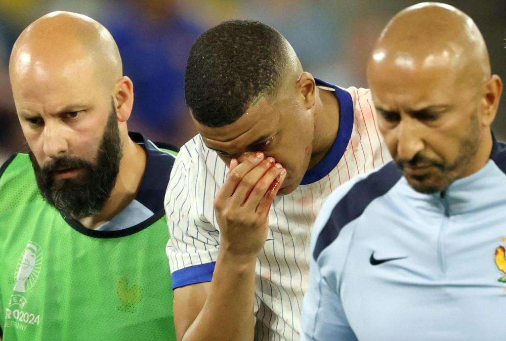 MBAPPE, "Che maschera metto?", l'appello sui social