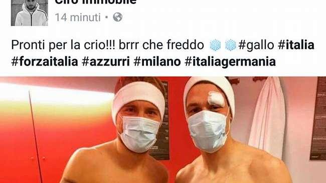 Italia, crioterapia per Immobile e Belotti: i gemelli del gol azzurri sfidano la Germania - FOTO