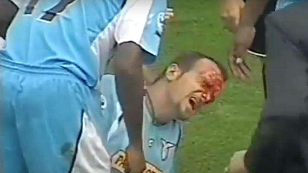 Parma - Lazio, il precedente: quando Rocchi diventò una maschera di sangue
