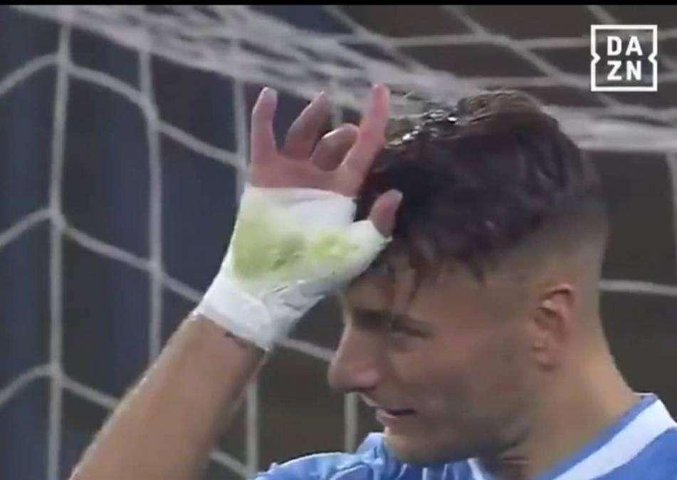 Lazio - Torino, Immobile alza la cresta: siparietto con Belotti - FOTO