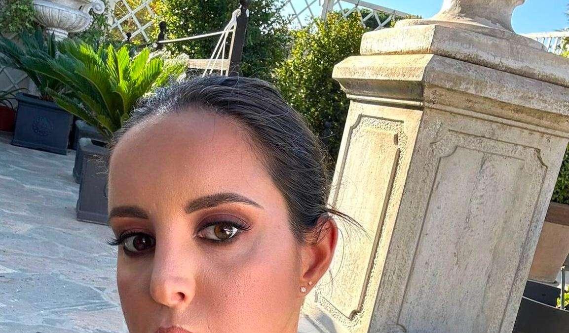 Mancini, la figlia Camilla svela: "Ho una malformazione al volto e mobilità ridotta"