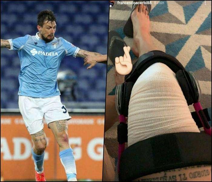 Acerbi dolorante nel post-derby: fasciatura, tutore e dita incrociante - FOTO