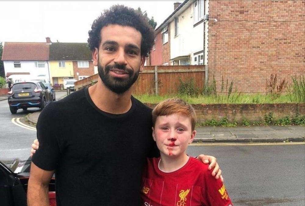 Liverpool, bambino si rompe il naso per vedere Salah - FOTO