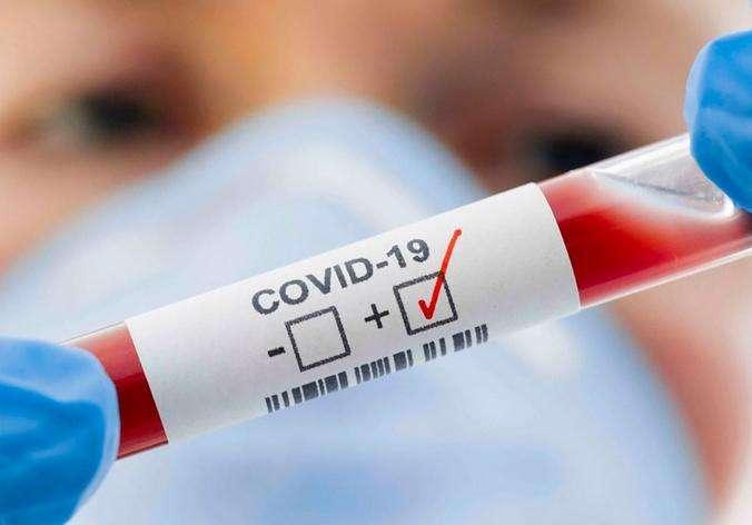 Serie D, sono dodici le gare di domani rinviate causa covid-19