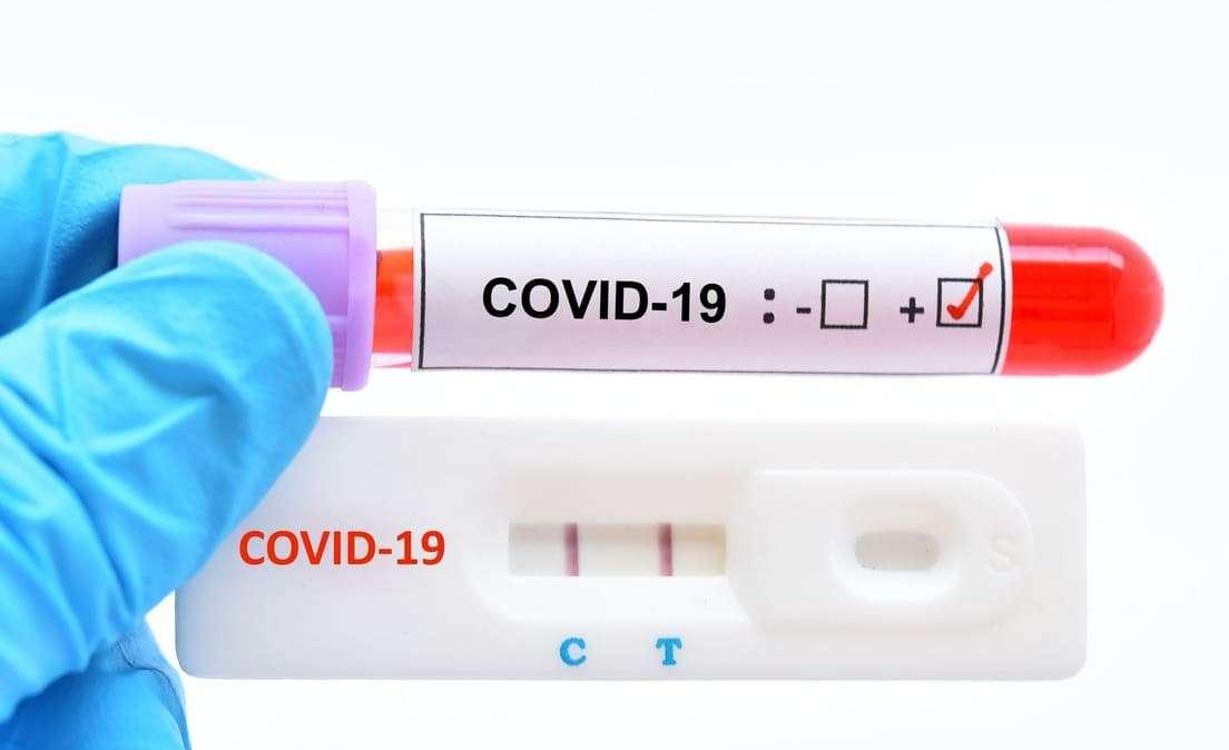 Covid-19, tampone positivo per un tesserato della Correggese. Allenamenti sospesi