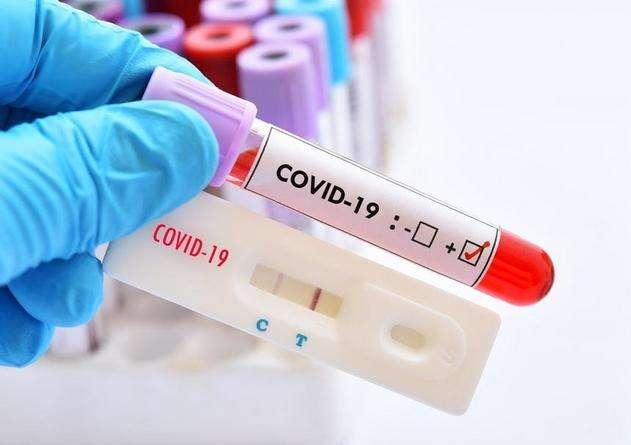 Coronavirus, il bollettino: in Italia è nuovo record di nuovi contagi 24.991 nuovi contagi e 205 morti