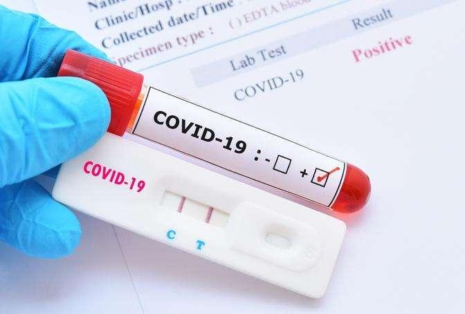 Cittanova, c'è un positivo al covid-19. Negativi tutti gli altri tesserati