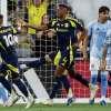 NYCFC Fall in Nashville Despite Fernández Mercau’s Heroics Before World Cup Break