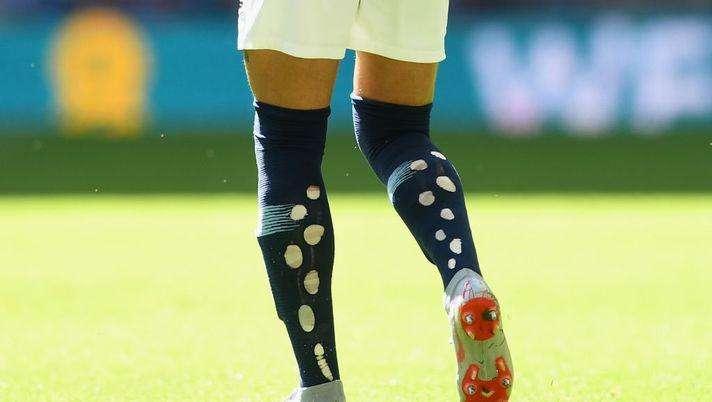 Why do players have holes in their socks?