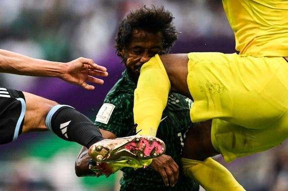 Arabia Saudita, se fractura la mandíbula y los huesos faciales para Al-Shahrani. Ya operado en Alemania