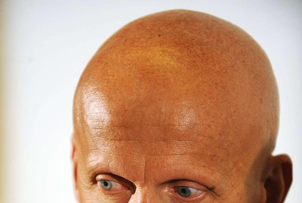 Collina, Soddisfatto per l'operato degli arbitri