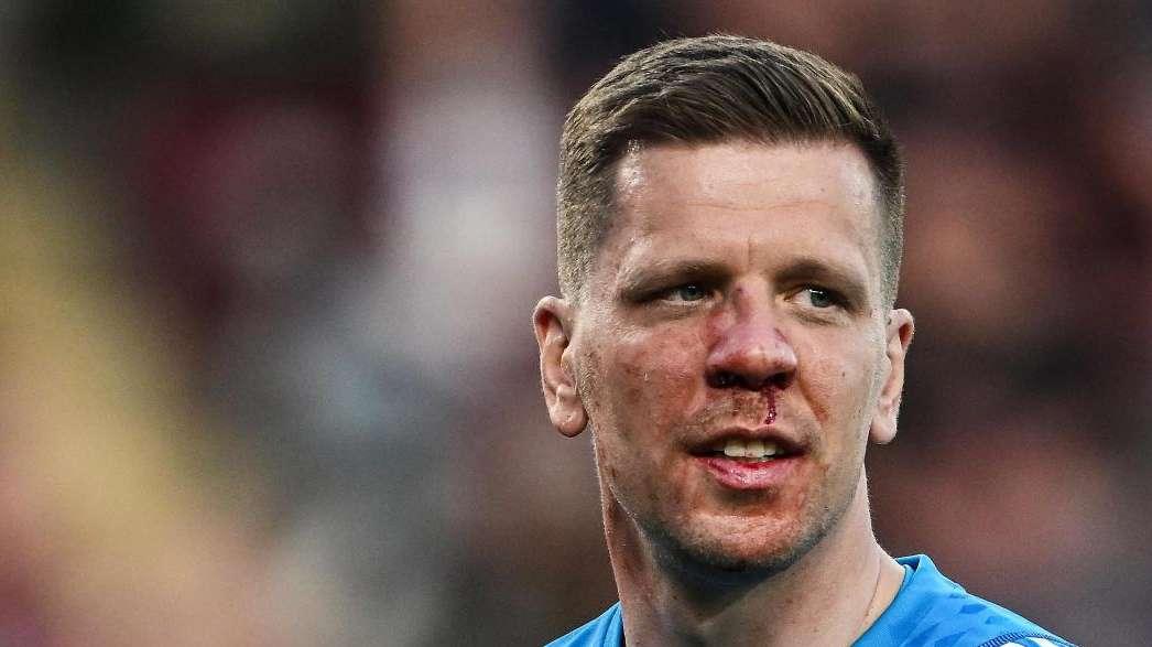 Szczesny, Europeo agrodolce