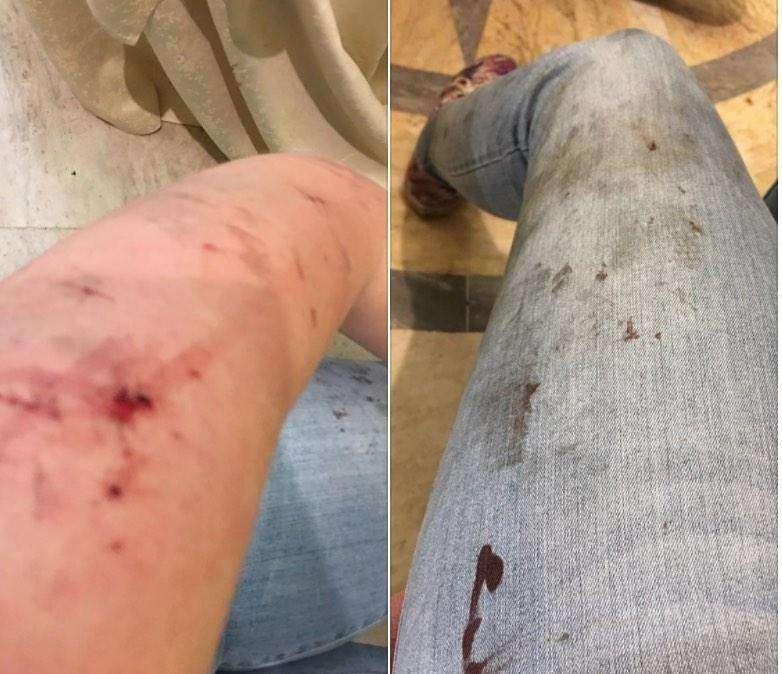 ESCLUSIVA TJ - L'inferno di Piazza San Carlo, la testimonianza di Alessia: "Pensavo di rimanere lì sotto e pregavo"