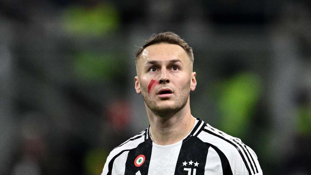 Sportmediaset - Koopmeiners involuto: fuori condizione e fuori posizione 