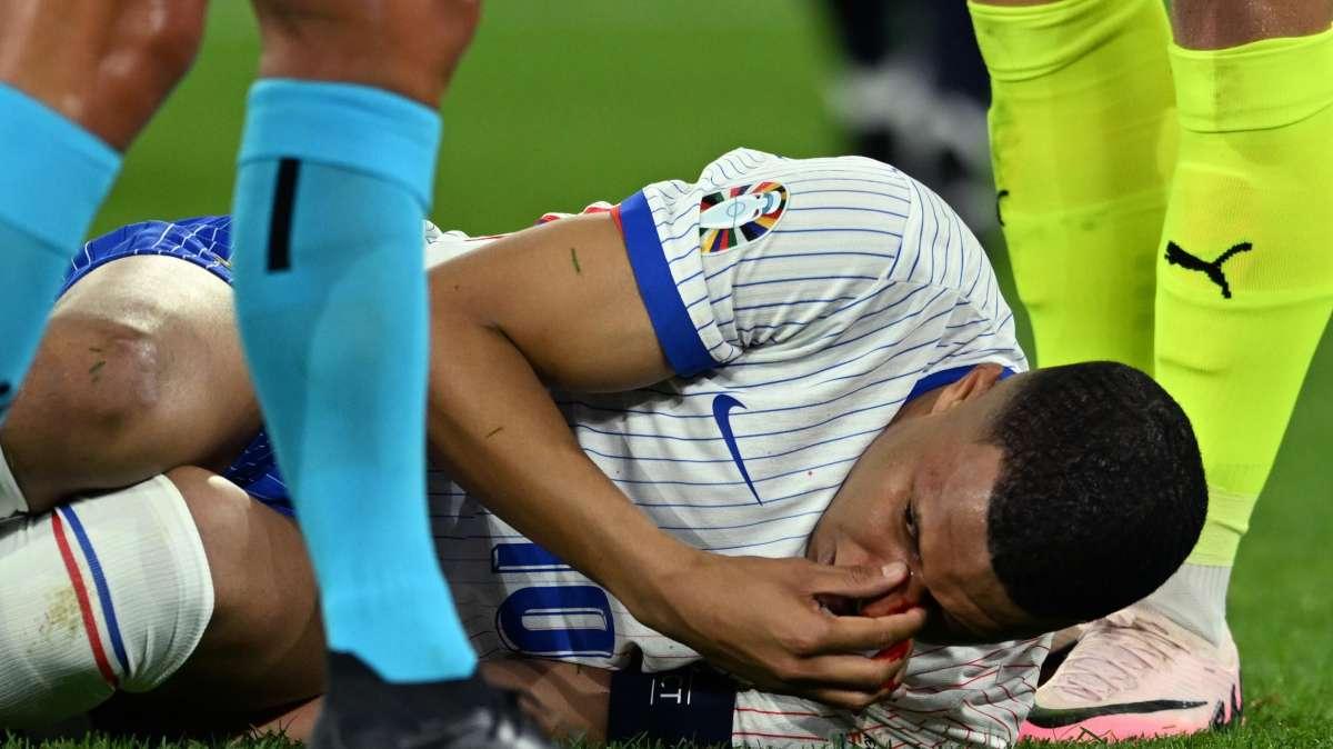Deschamps: "Cerchiamo di recuperare Mbappé già per l'Olanda"