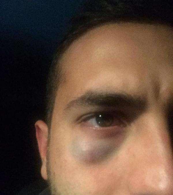 "Napoletani di m***a", vergognosa imboscata dopo Lazio-Napoli: la testimonianza di un tifoso azzurro
