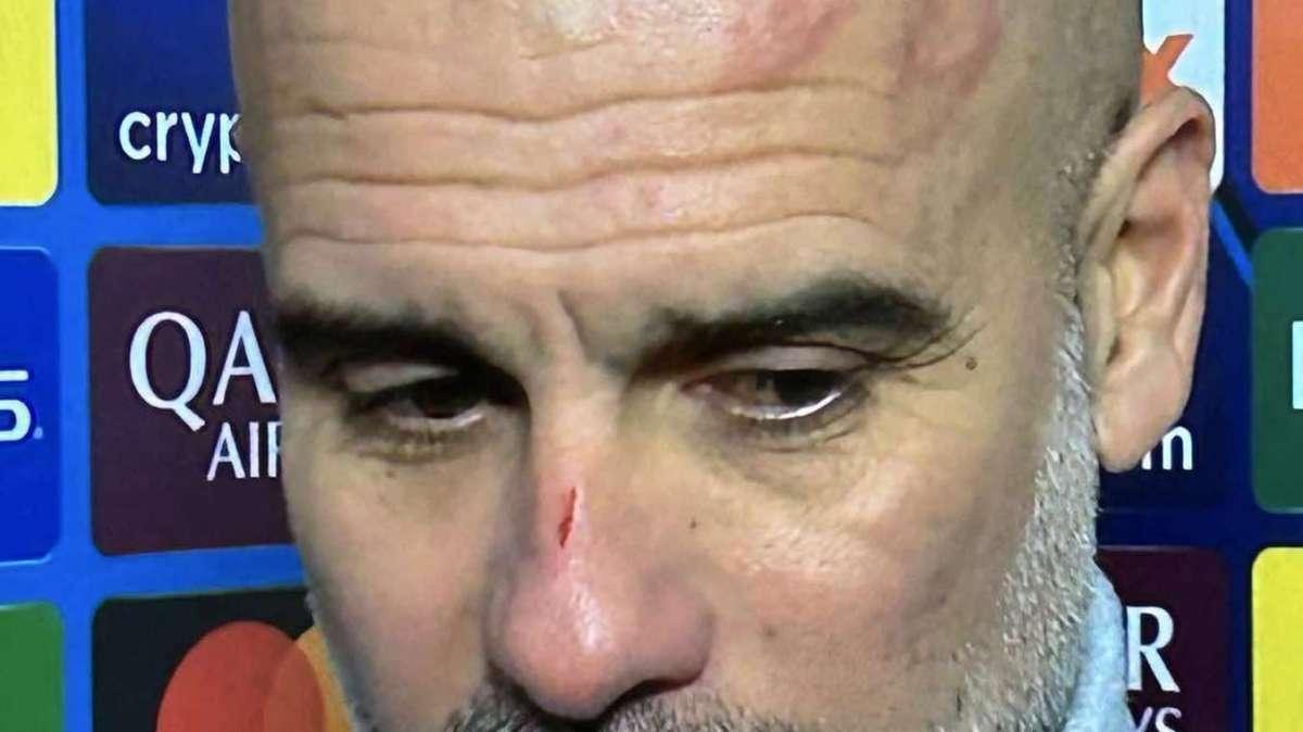 City smarrito, furia Guardiola: "Cosa dovremmo fare? Piangere perché Rodri non c'è?"