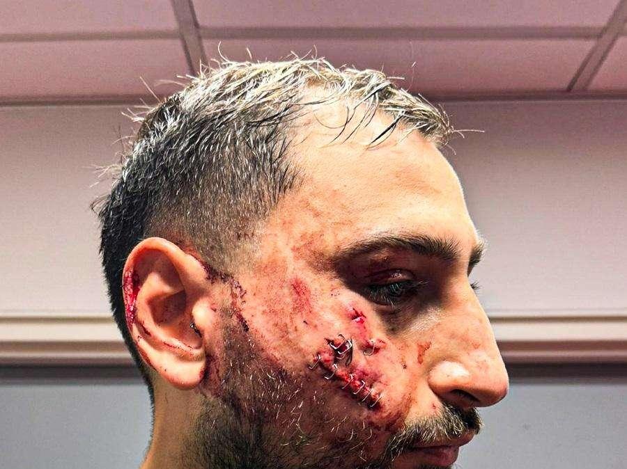 La frase detta da Donnarumma a Singo dopo il terribile scontro