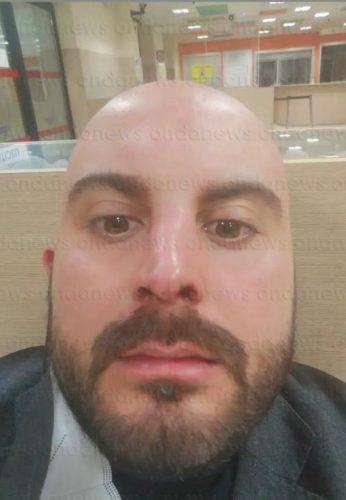 Calcio violento a Tito, allenatore del Ruoti colpito da una testata che gli procura la rottura del naso
