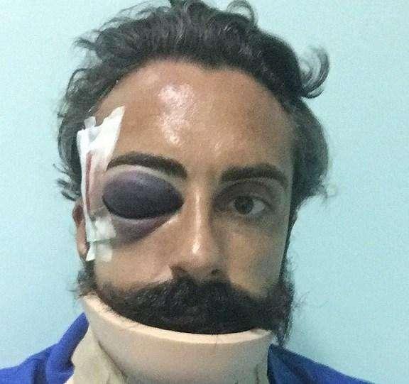 Guardate come hanno ridotto l'ex difensore del Picerno Pascuccio...