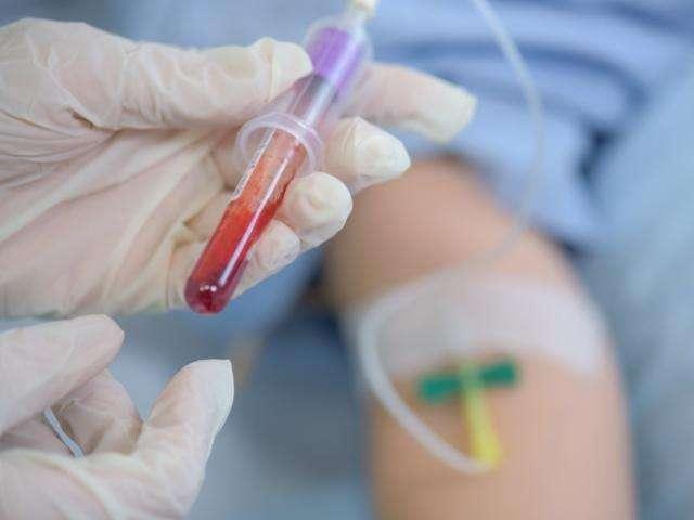 Ecco quali esame del sangue deve fare il podista per capire se è in forma e come intervenire