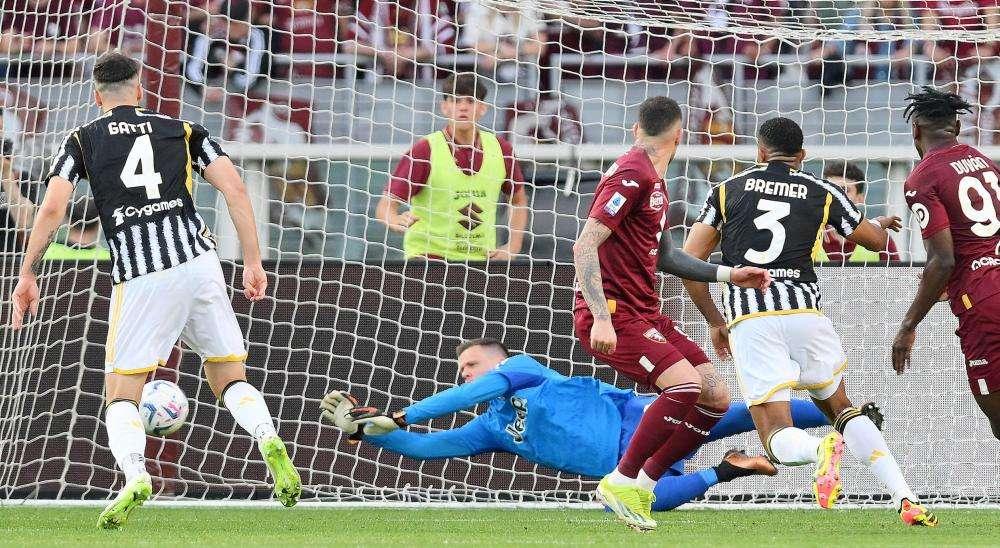 Juventus: Szczesny operato per la frattura del naso