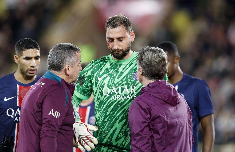 PSG, Donnarumma rassicura sui social: "Tutto bene"