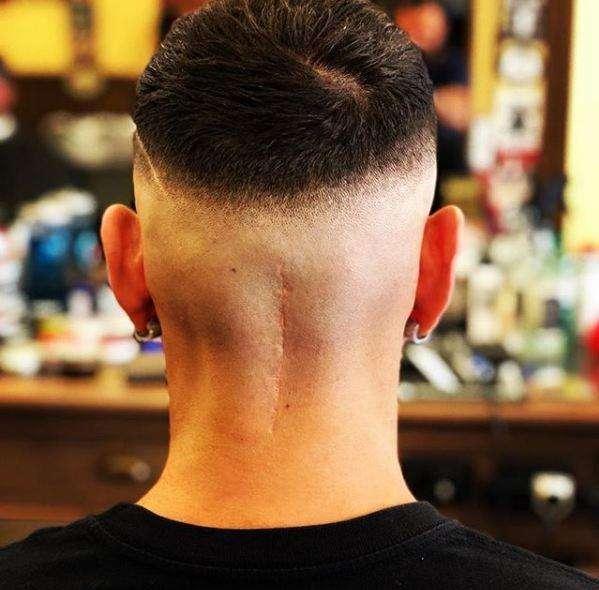Castan mostra la sua cicatrice: "Un segno della mia rinascita". FOTO!
