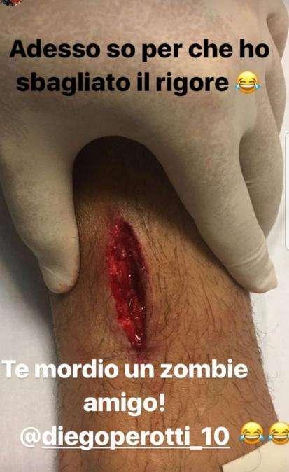 Instagram, Perotti scherza sulla ferita: "Adesso so perché ho sbagliato il rigore". Fazio: "Ti ha morso uno zombie"